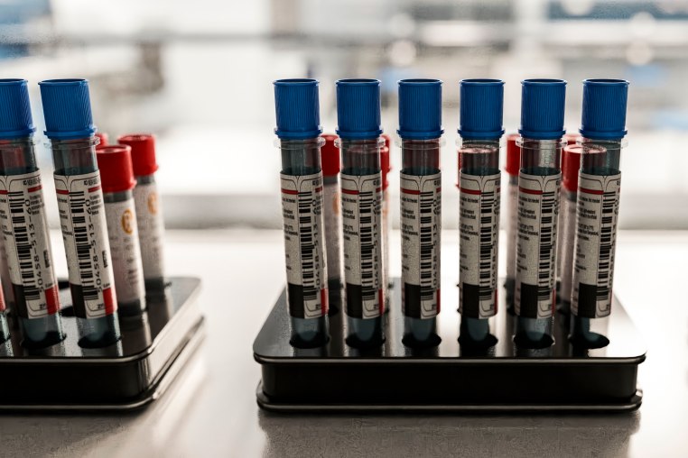 Blood samples in test tubes for medical diagnostics