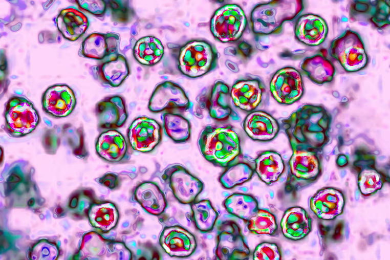 Measles Virus