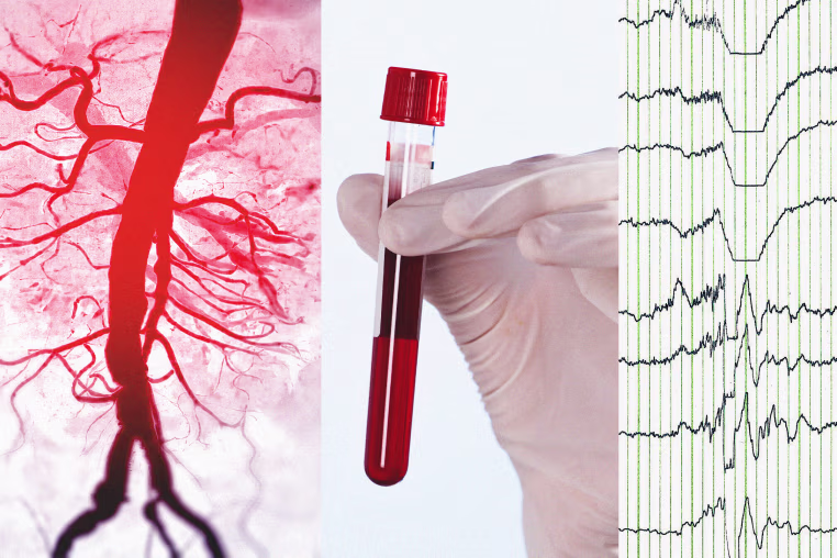 Photo illustration showing a 3D rendering of an aorta, a vial of blood, and an EEG reading 