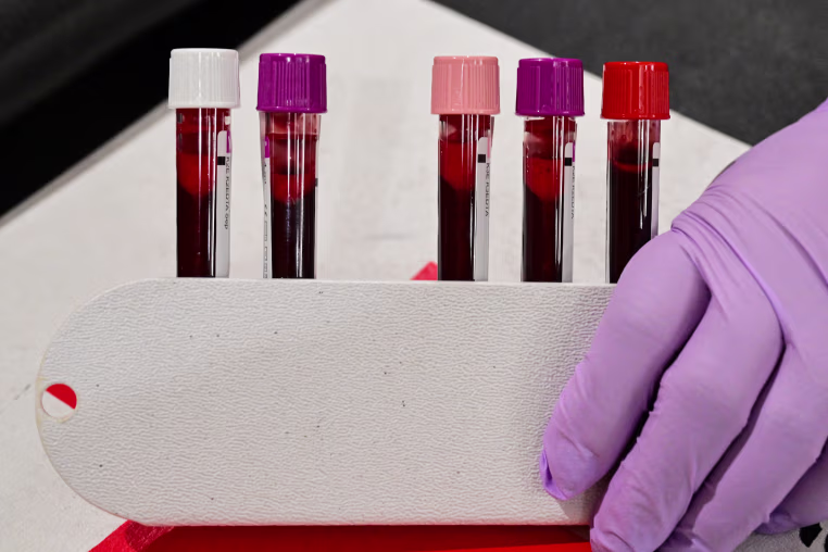 Vials containing blood.