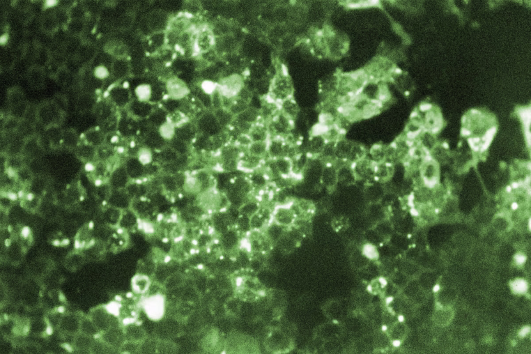 rubeola (measles) virus antigen.