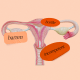 Illustration of a female reproductive system with sticker labels that read \"barren,\" \"incompetent\" and \"hostile.\"