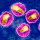 Aids virus, tem