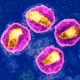 A transmission electron microscopy image of HIV.