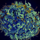 Imagen de microscopio electrónico facilitada por los Institutos Nacionales de Salud de EE.UU. donde se muestra una célula T humana, en azul, atacada por el VIH, en amarillo, el virus que causa el sida.