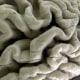 Imagen de archivo de una sección de un cerebro humano con enfermedad de Alzheimer, en Nueva York, el 7 de octubre de 2003. 