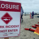 A 46-year-old man was sent to the hospital after being bitten by a shark in Del Mar around 9 a.m. on Sunday, prompting Del Mar lifeguards to close beaches for swimming and surfing in the area.