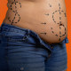 Person in unzipped jeans with stomach marked up with dollar signs and arrows 