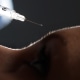 Botox injection