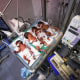 Premature babies struggle for life in Gaza under Israeli attacks