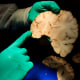 A doctor holds brain tissue
