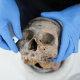 A human skull excavated in Colombia