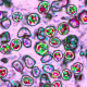 Measles Virus