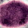 Monkeypox virus present in Human vesicular fluid.