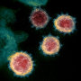 Image: Transmission electron microscope image shows SARS-CoV-2, also known as novel coronavirus.