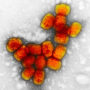 Image: A transmission electron micrograph of smallpox viruses.