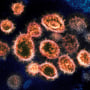 Partículas del virus del SARS-CoV-2, causante del COVID-19, de un paciente en EE.UU.