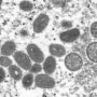 Esta imagen de microscopio de 2003 proporcionada por los CDC muestra a la viruela de simio.