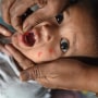 A health worker administers a vaccine to a child at a temporary vaccination camp following a measles outbreak in Mumbai, India, on Nov. 23, 2022.