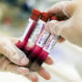 Laboratory technician holding test tubes containing blood samples (Photo by Universal Images Group via Getty Images)