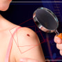 Nueva tecnología 3D podría detectar cáncer de piel en tan solo 12 minutos