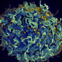 An electron microscope image shows a human T cell, blue, under attack by HIV, yellow, the virus that causes AIDS. 