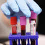 Blood is collected for testing at a New York Blood Center location  in Brooklyn.