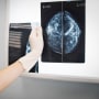 Doctor holding a mammogram in front of x-ray illuminator
