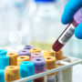 Hand of pathologist holding a blood sample in test tube at laboratory