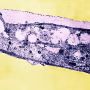 Syphilis Bacterium
