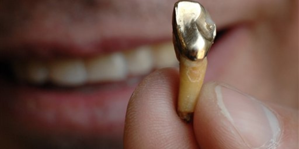 There&rsquo;s gold (and big bucks) in them thar grills