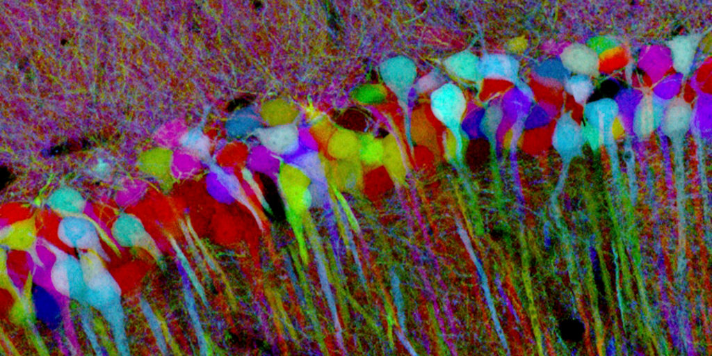 Brainbow Hippocampus
