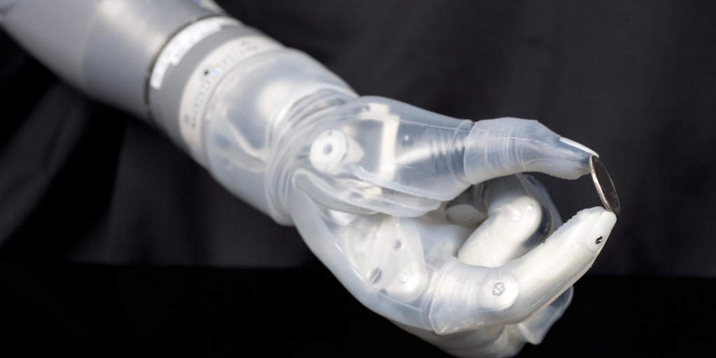 It's not 'Star Wars'-level tech yet, but doctors get a step closer to a  bionic hand with special surgery and AI