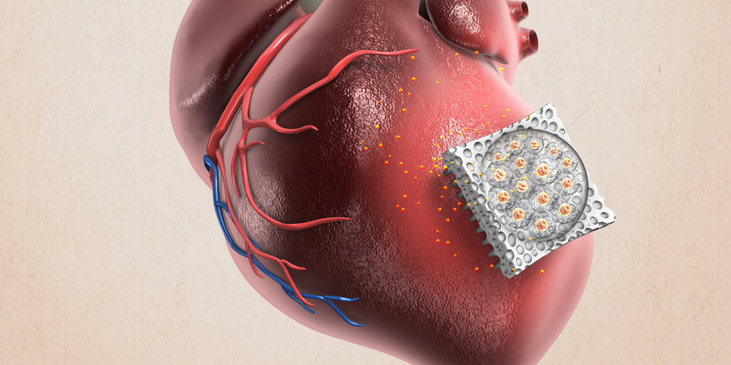 This needle-studded patch could help heart patients heal
