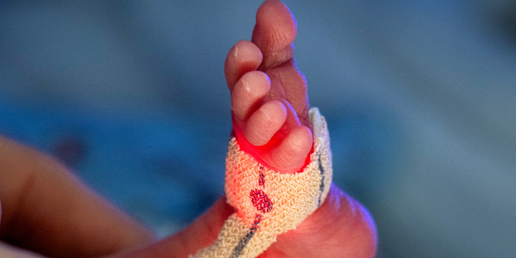 Premature births in the U.S. remain at an all-time high, the March of Dimes reports