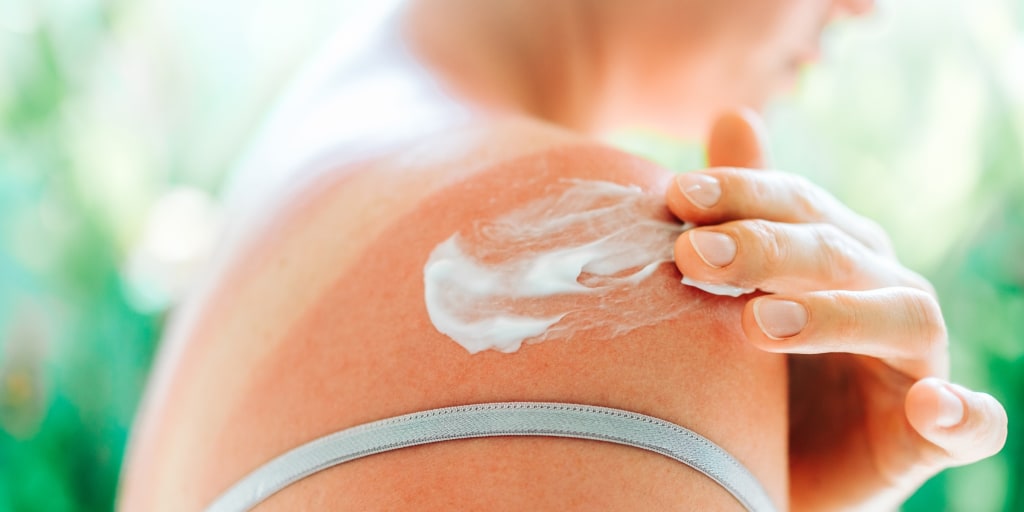 Experts explain how to differentiate sunburn from conditions like heat rash and sun poisoning. - @​nbcselected <https://t.co/6971UiowJZ>
 [↧](https://t.co/6971U