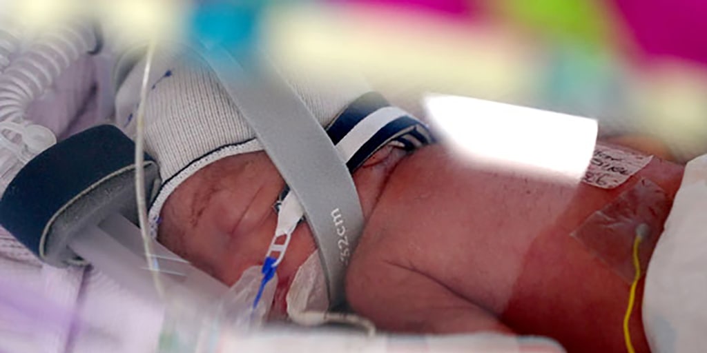 Most parents think their kids are one in a million. But these spontaneous identical quadruplets are one in 15 million. <https://t.co/6lD0RaRAHC>
 [↧](https://t.