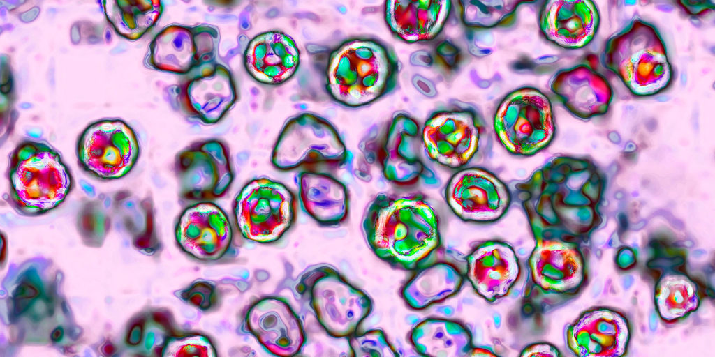A fourth death has been linked to measles in Pennsylvania, the state health department says.