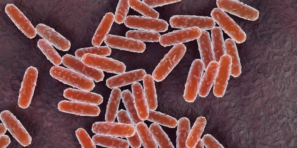 Almost 200 people are under medical observation in Russia’s Siberia region after the death of a 28-year-old lab worker who may have been exposed to pneumonic plague, according to local media reports.