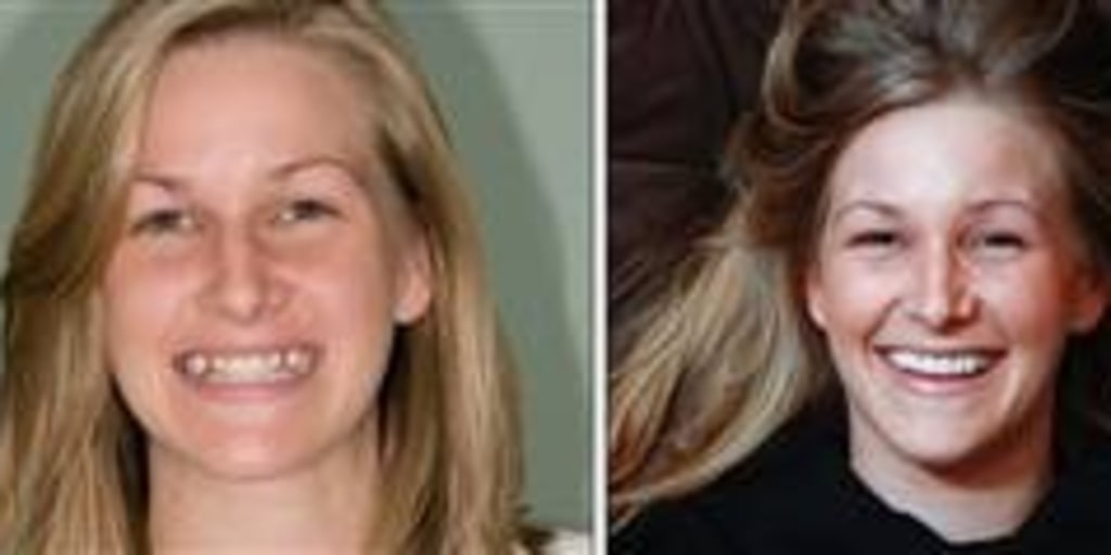 Weird Vintage Porn Actress Teeth - Her baby teeth are finally gone -- at age 28?