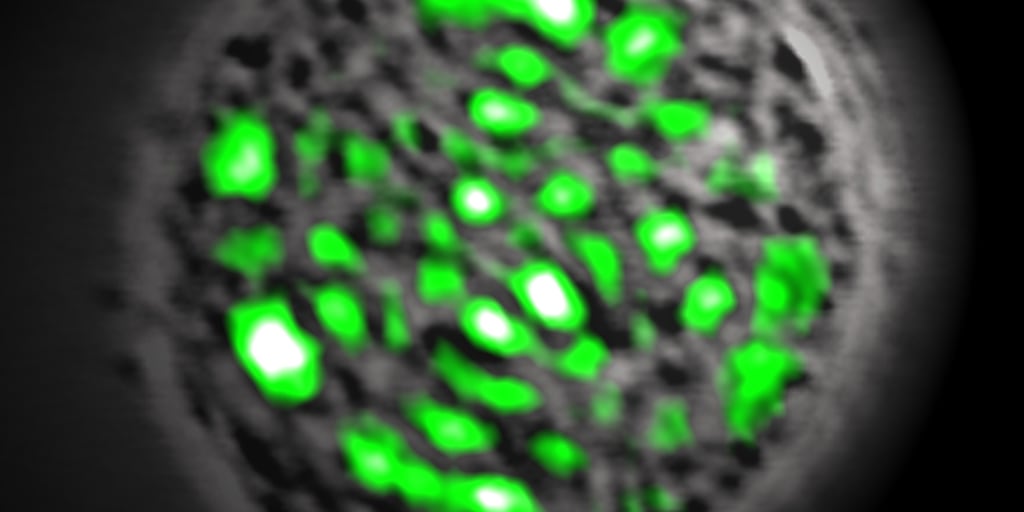 Клетка способная захватывать. Клетки флуоресцируют зелёным. Лазерная клетка. Флюоресцирующий зеленый механодолгоног. Клетка из лазерных лучей.