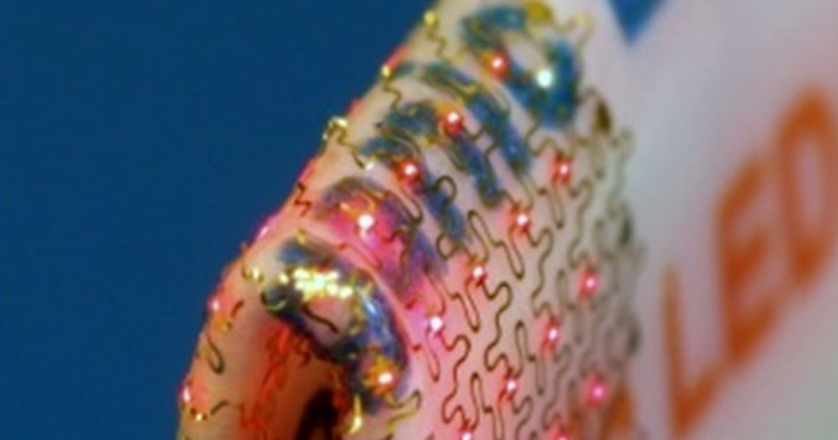 Stretch Device Led Stretchable LEDs could mean better medical implants