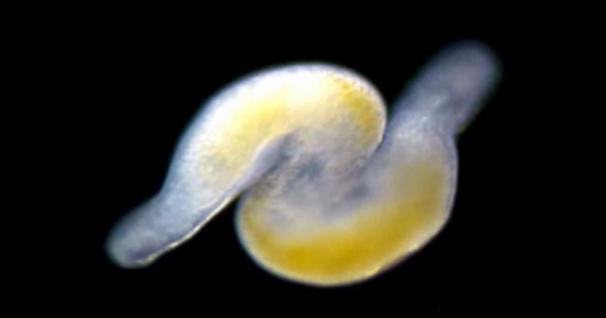 Worm Porn Sheds Light On Evolution Of Sperm 0032