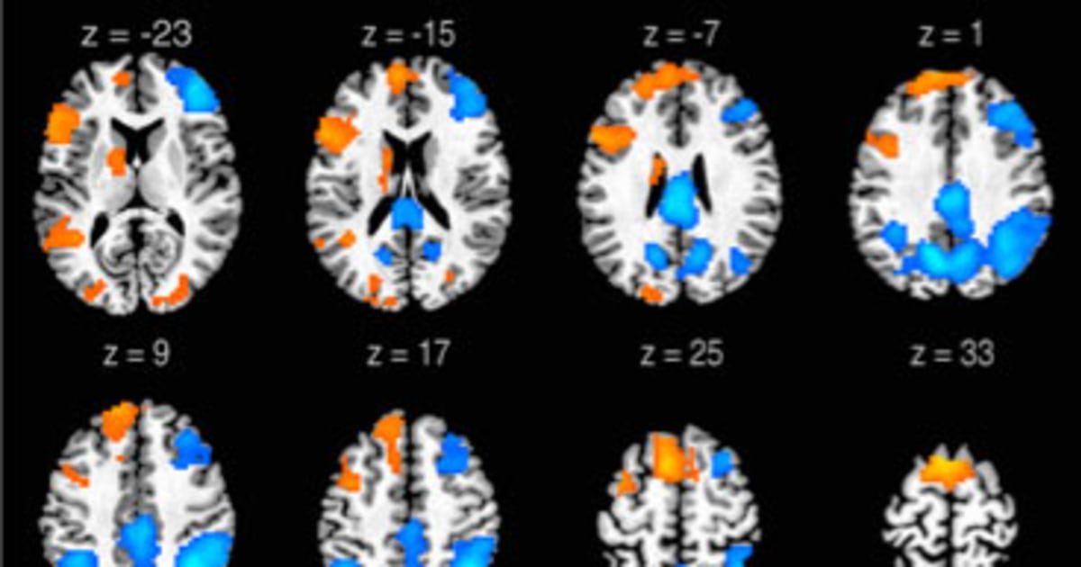 How the brain lets rappers bust freestyle rhymes on the spot