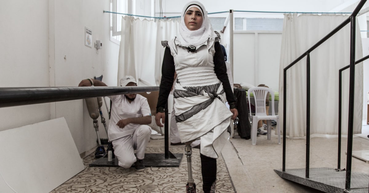 Syiran Girl Adjusts to Life as an Amputee