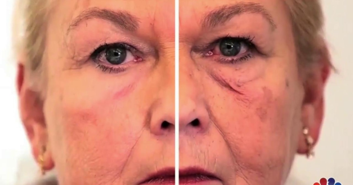 Facelift in a Bottle? MIT Team Develops a Temporary 'Second Skin'