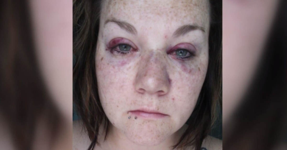 Police Investigate Attack on Lesbian Couple in Iowa