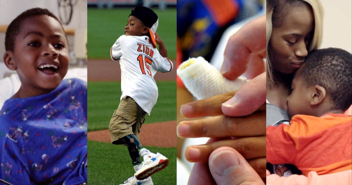 After Double Hand Transplant, What’s Next for Zion Harvey?