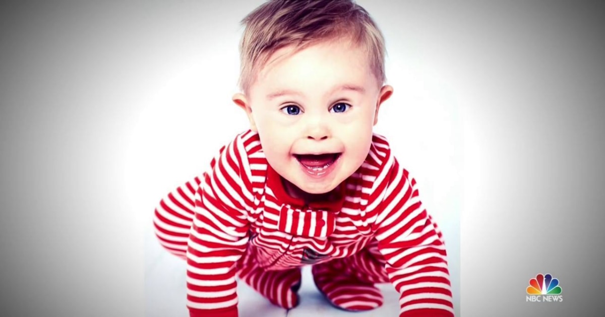 This Kid Is The Face of Change In Baby Modelling