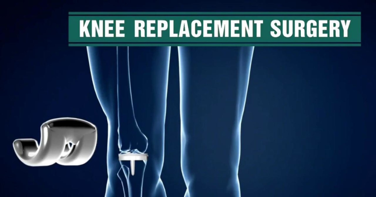 new research on knee replacement surgery